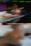 Naked woman getting enemas
